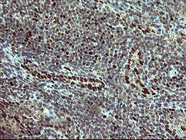 FOXP1 Antibody in Immunohistochemistry (Paraffin) (IHC (P))