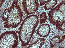 FOXP1 Antibody in Immunohistochemistry (Paraffin) (IHC (P))