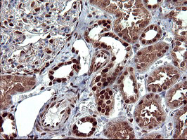 FOXP1 Antibody in Immunohistochemistry (Paraffin) (IHC (P))