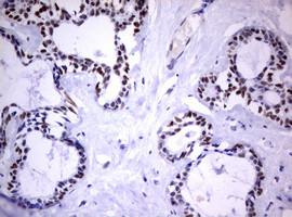 FOXP1 Antibody in Immunohistochemistry (Paraffin) (IHC (P))