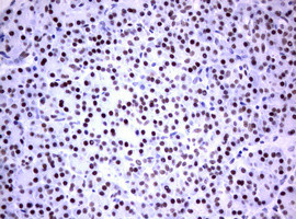 FOXP1 Antibody in Immunohistochemistry (Paraffin) (IHC (P))