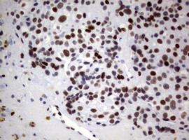 FOXP1 Antibody in Immunohistochemistry (Paraffin) (IHC (P))