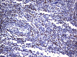 FOXP1 Antibody in Immunohistochemistry (Paraffin) (IHC (P))