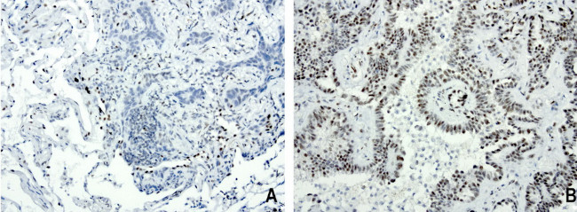 FOXP1 Antibody in Immunohistochemistry (Paraffin) (IHC (P))