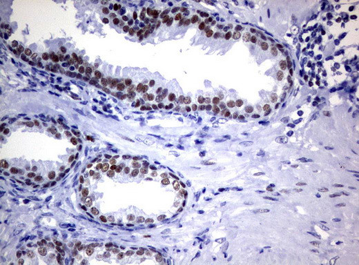 FOXP1 Antibody in Immunohistochemistry (Paraffin) (IHC (P))