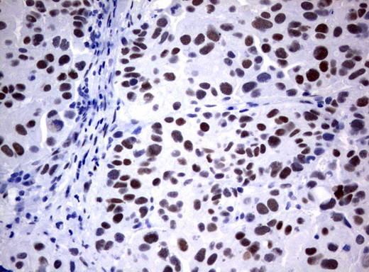 FOXP1 Antibody in Immunohistochemistry (Paraffin) (IHC (P))