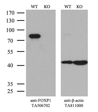 FOXP1 Antibody