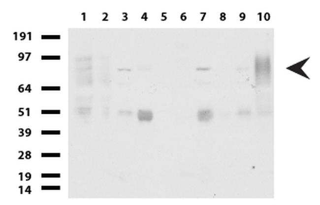 FOXP1 Antibody in Western Blot (WB)