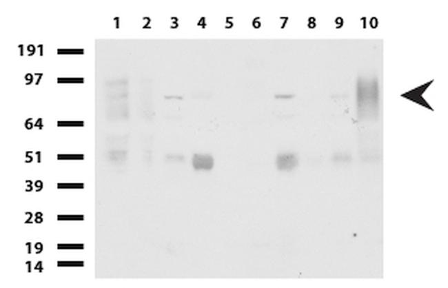 FOXP1 Antibody in Western Blot (WB)