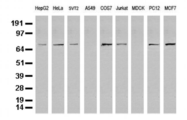 FOXP1 Antibody in Western Blot (WB)