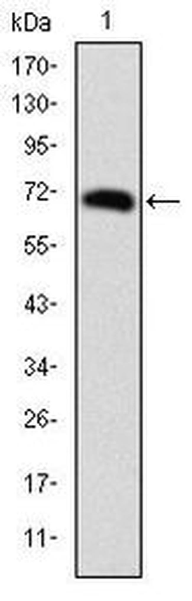 FOXP2 Antibody in Western Blot (WB)