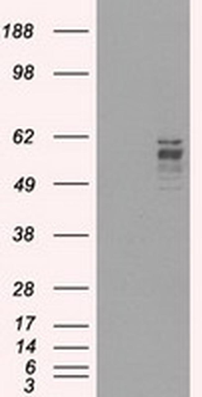 FRK Antibody in Western Blot (WB)