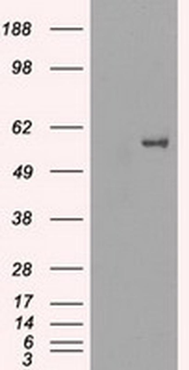 FRK Antibody in Western Blot (WB)