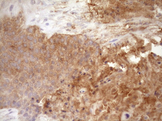 FSCN1 Antibody in Immunohistochemistry (Paraffin) (IHC (P))