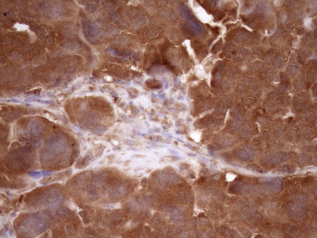 FSCN1 Antibody in Immunohistochemistry (Paraffin) (IHC (P))