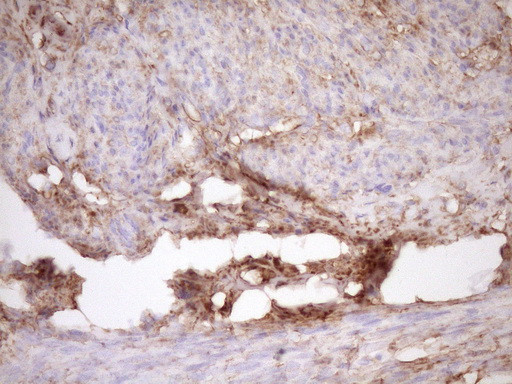 FSCN1 Antibody in Immunohistochemistry (Paraffin) (IHC (P))