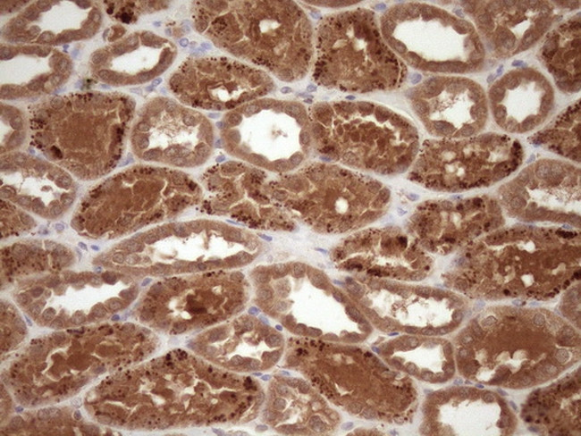 FSCN1 Antibody in Immunohistochemistry (Paraffin) (IHC (P))