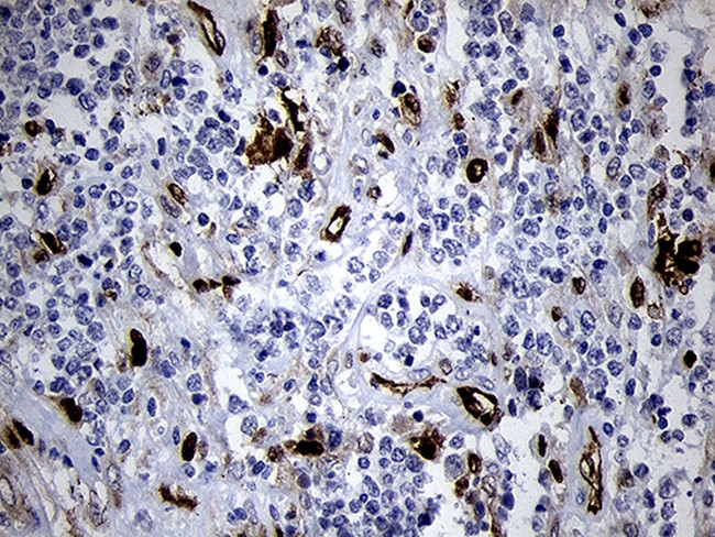 FSCN1 Antibody in Immunohistochemistry (Paraffin) (IHC (P))