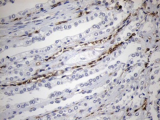 FSCN1 Antibody in Immunohistochemistry (Paraffin) (IHC (P))