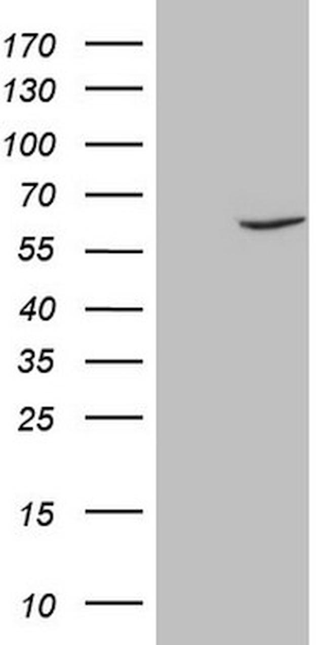 FSCN1 Antibody in Western Blot (WB)