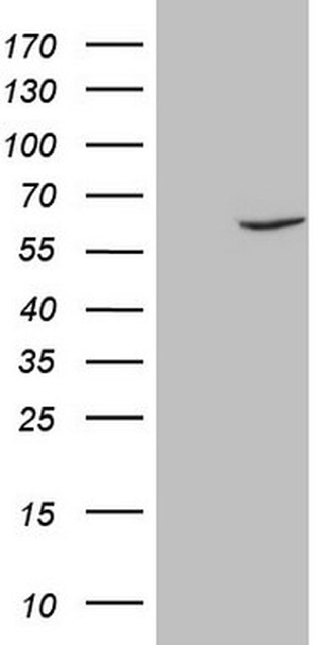 FSCN1 Antibody in Western Blot (WB)