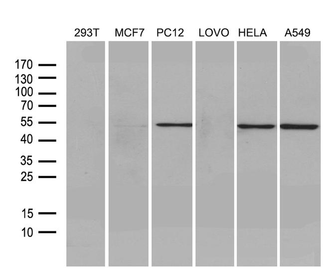 FSCN1 Antibody in Western Blot (WB)