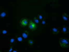 FSHB Antibody in Immunocytochemistry (ICC/IF)