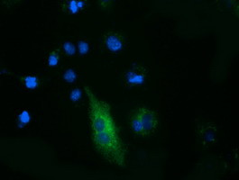 FSHB Antibody in Immunocytochemistry (ICC/IF)