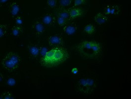 FSHB Antibody in Immunocytochemistry (ICC/IF)