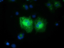 FSHB Antibody in Immunocytochemistry (ICC/IF)