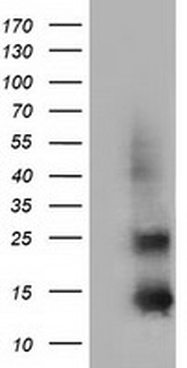 FSHB Antibody in Western Blot (WB)