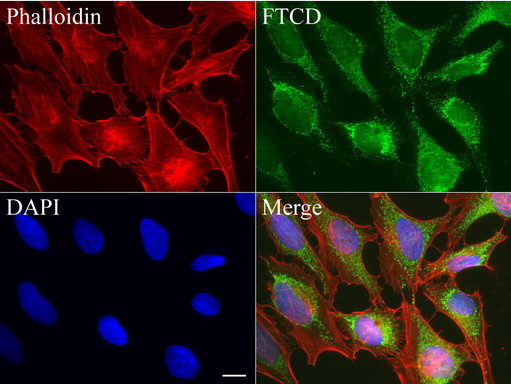 FTCD Antibody in Immunocytochemistry (ICC/IF)