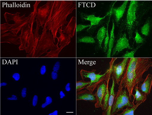 FTCD Antibody in Immunocytochemistry (ICC/IF)