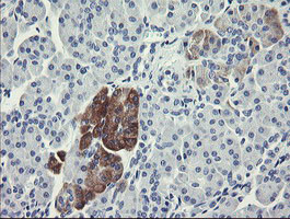 FTCD Antibody in Immunohistochemistry (Paraffin) (IHC (P))