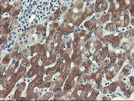 FTCD Antibody in Immunohistochemistry (Paraffin) (IHC (P))