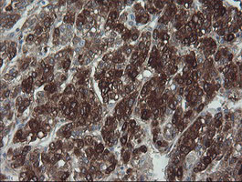 FTCD Antibody in Immunohistochemistry (Paraffin) (IHC (P))