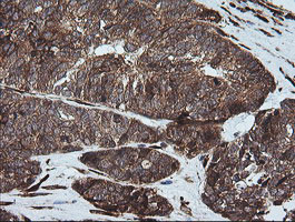 FTCD Antibody in Immunohistochemistry (Paraffin) (IHC (P))