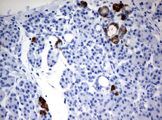 FTCD Antibody in Immunohistochemistry (Paraffin) (IHC (P))