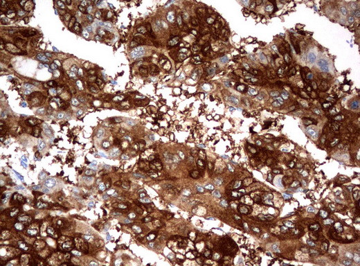 FTCD Antibody in Immunohistochemistry (Paraffin) (IHC (P))