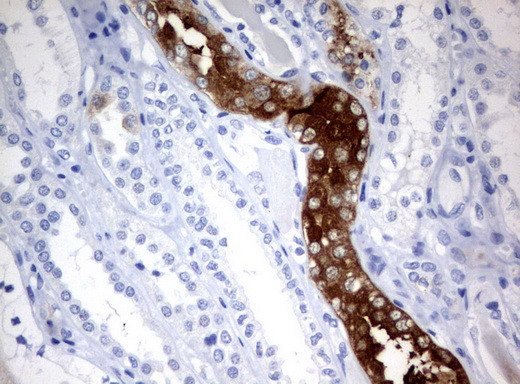 FTCD Antibody in Immunohistochemistry (Paraffin) (IHC (P))