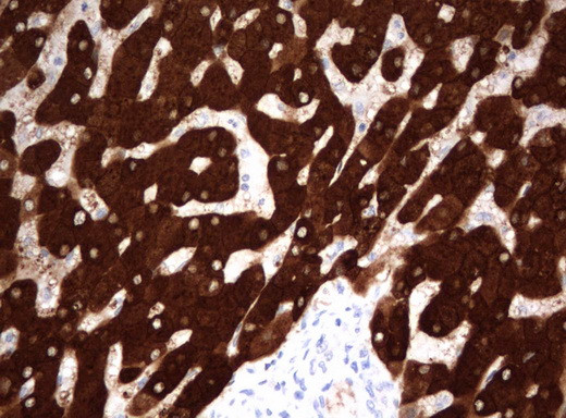 FTCD Antibody in Immunohistochemistry (Paraffin) (IHC (P))