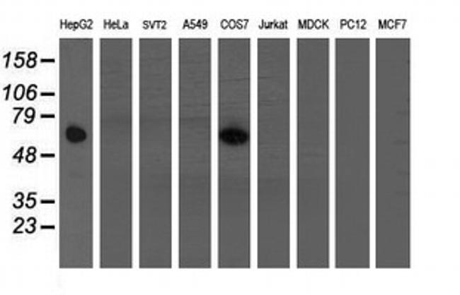 FTCD Antibody in Western Blot (WB)