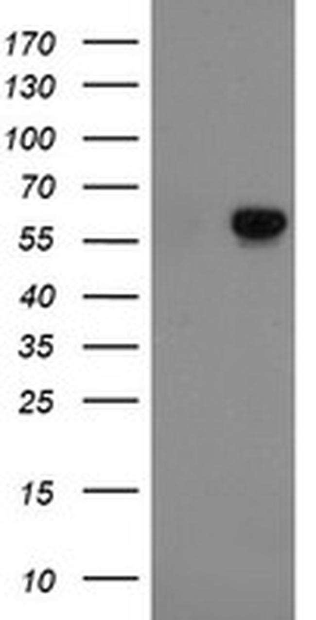 FTCD Antibody in Western Blot (WB)