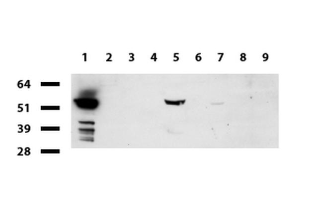 FTCD Antibody in Western Blot (WB)