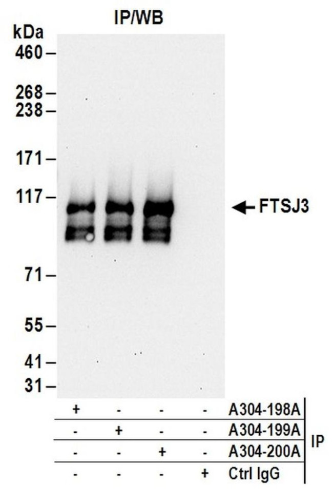 FTSJ3 Antibody in Immunoprecipitation (IP)