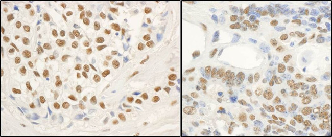 FUS Antibody in Immunohistochemistry (IHC)