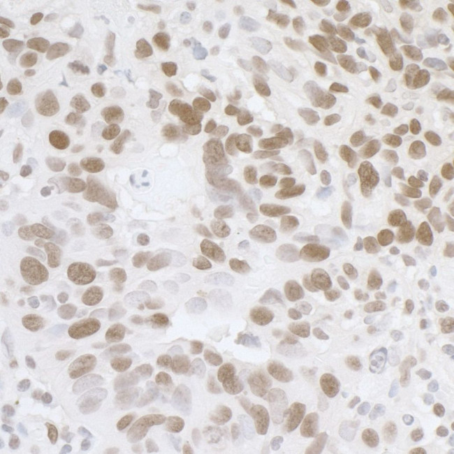 FUS Antibody in Immunohistochemistry (IHC)