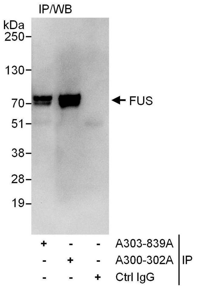 FUS Antibody in Western Blot (WB)