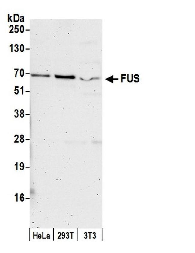 FUS Antibody in Western Blot (WB)