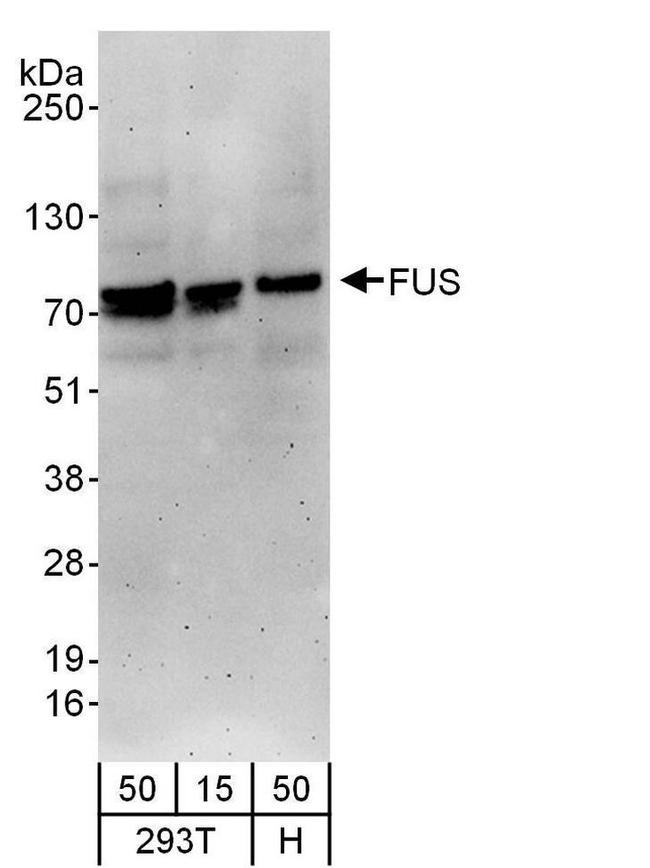 FUS Antibody in Western Blot (WB)